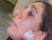 التحقيق فى واقعة تعدى زوج على زوجته بسبب قضية خلع بمحكمة الدخيلة بالإسكندرية