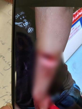 المجنى علية (1) المجنى علية (1)